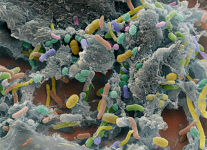 Le Microbiome Intestinal