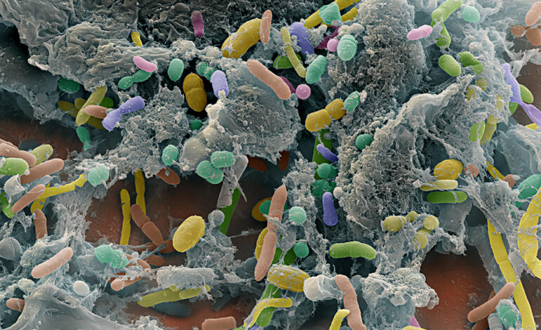 Le Microbiome Intestinal