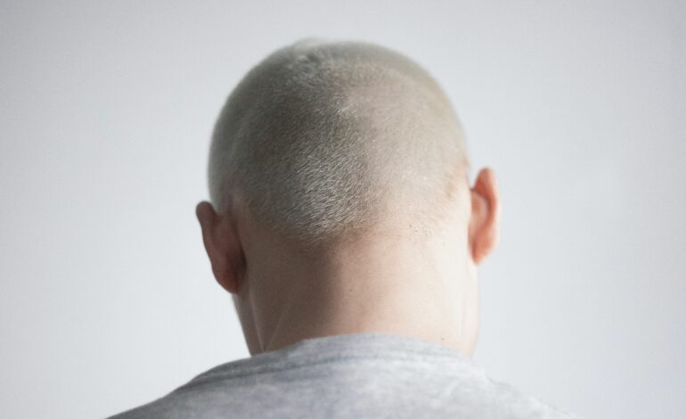  Comment lutter efficacement contre la calvitie : méthodes naturelles et solutions adaptées